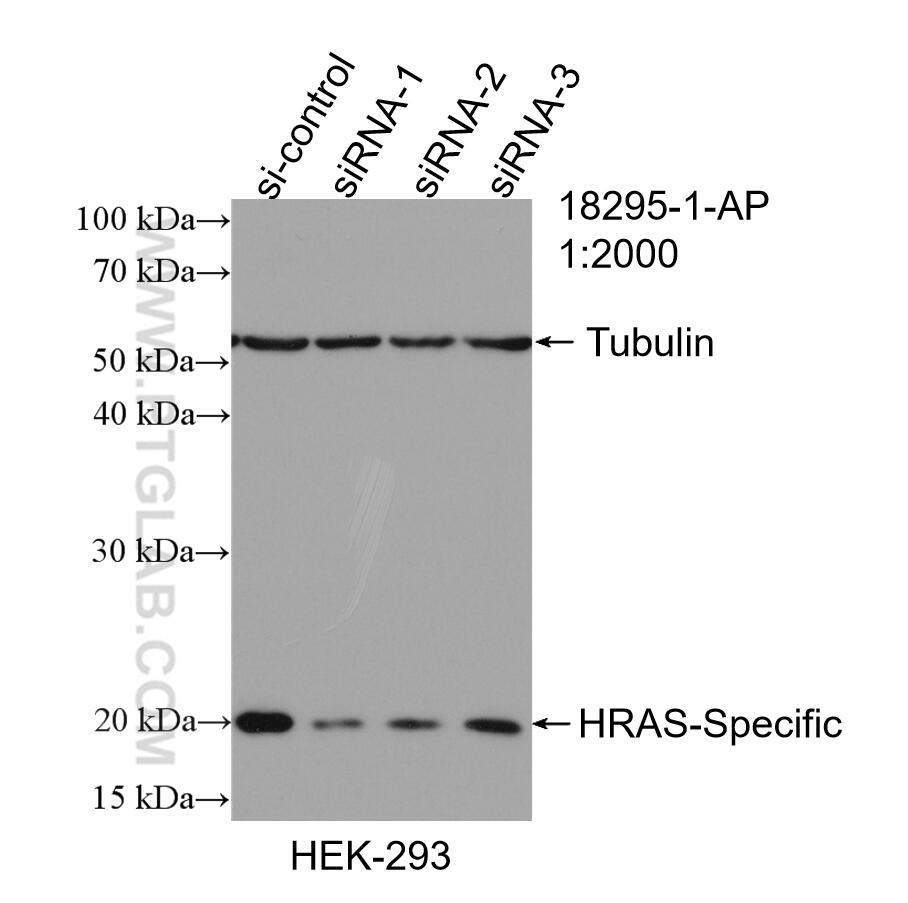 Western Blot (WB) analysis of HEK-293 cells using HRAS-Specific Polyclonal antibody (18295-1-AP)