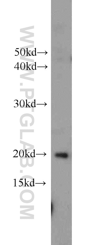 Western Blot (WB) analysis of PC-3 cells using HRAS-Specific Polyclonal antibody (18295-1-AP)