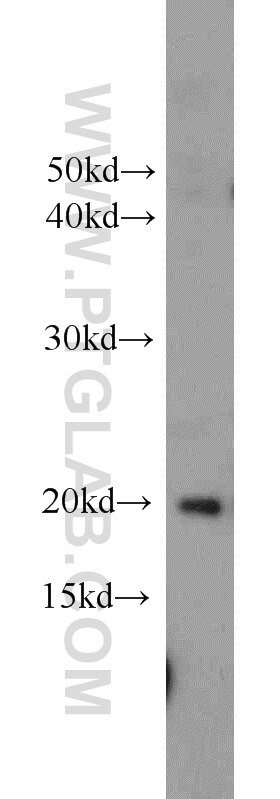 WB analysis of PC-3 using 18295-1-AP