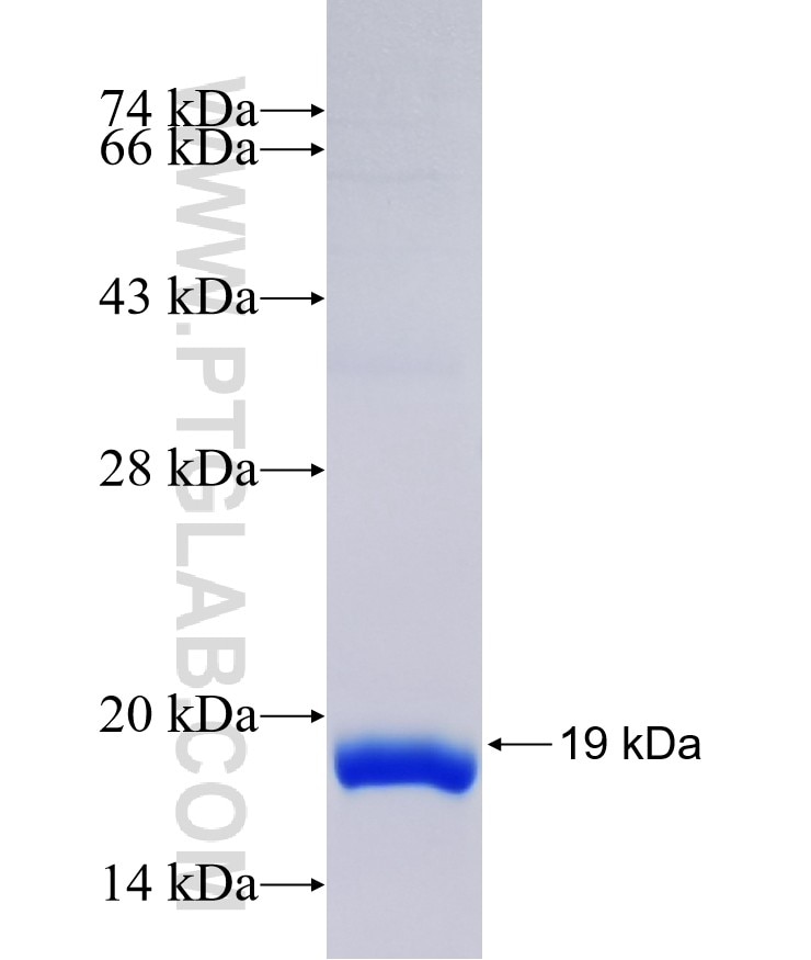 HRASLS fusion protein Ag38343 SDS-PAGE