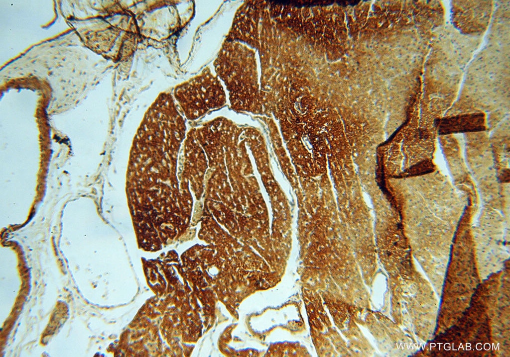 Immunohistochemistry (IHC) staining of human heart tissue using HRASLS5 Polyclonal antibody (17581-1-AP)