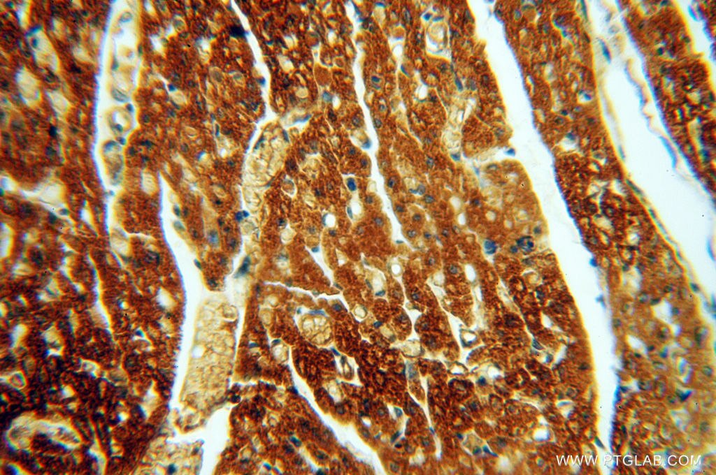 Immunohistochemistry (IHC) staining of human heart tissue using HRASLS5 Polyclonal antibody (17581-1-AP)