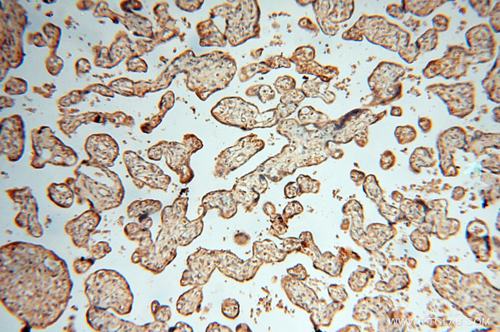Immunohistochemistry (IHC) staining of human placenta tissue using HRASLS5 Polyclonal antibody (17581-1-AP)