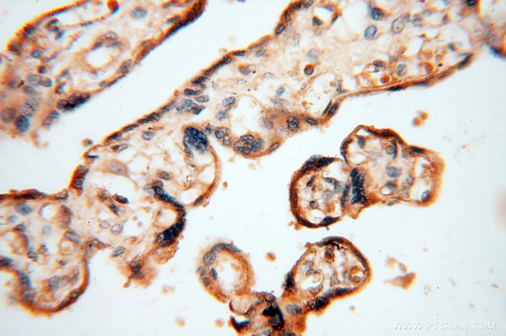Immunohistochemistry (IHC) staining of human placenta tissue using HRASLS5 Polyclonal antibody (17581-1-AP)