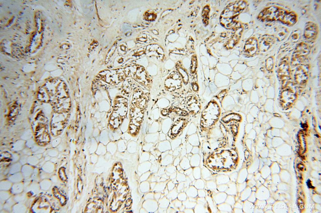 Immunohistochemistry (IHC) staining of human skin tissue using HRASLS5 Polyclonal antibody (17581-1-AP)