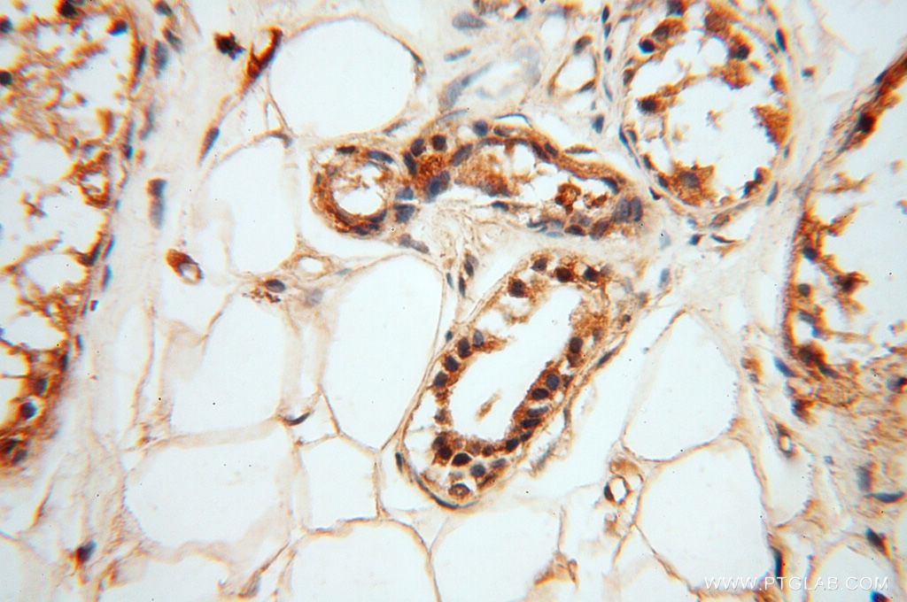 Immunohistochemistry (IHC) staining of human skin tissue using HRASLS5 Polyclonal antibody (17581-1-AP)