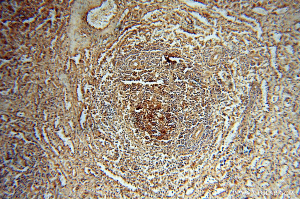 IHC staining of human spleen using 17581-1-AP