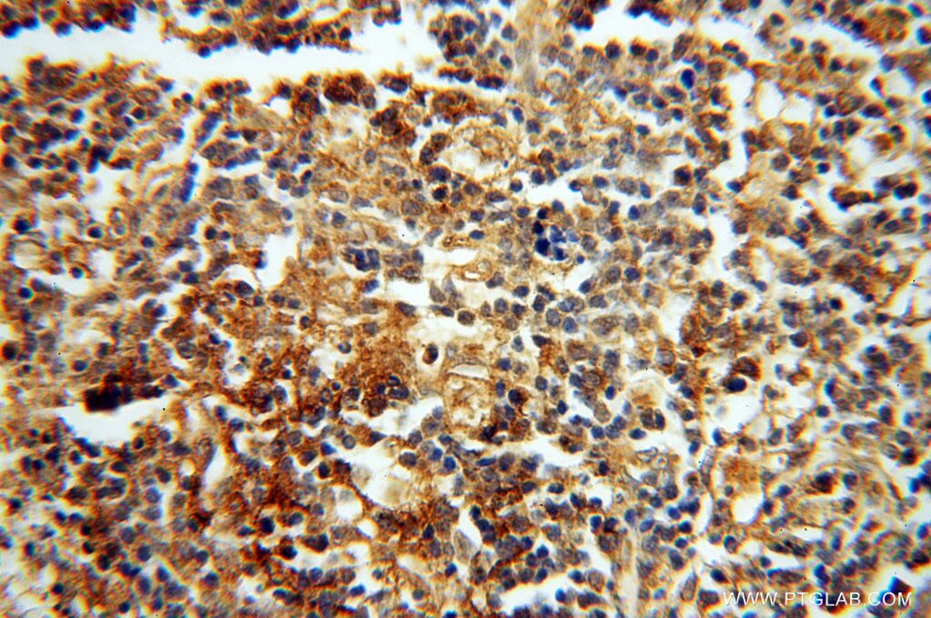 Immunohistochemistry (IHC) staining of human spleen tissue using HRASLS5 Polyclonal antibody (17581-1-AP)