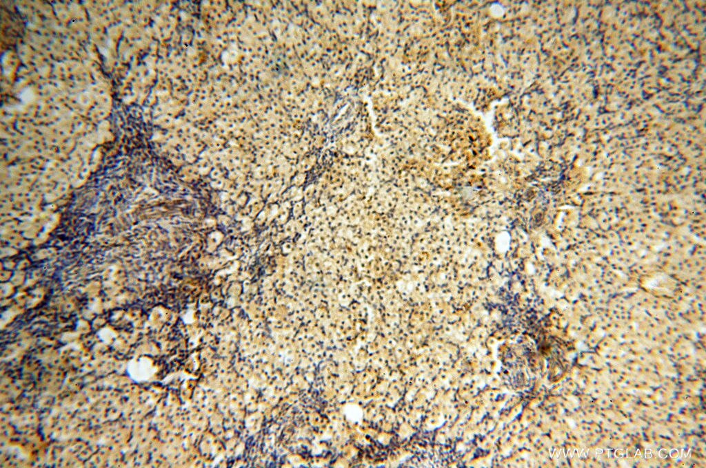 Immunohistochemistry (IHC) staining of human ovary tissue using HRASLS5 Polyclonal antibody (17581-1-AP)