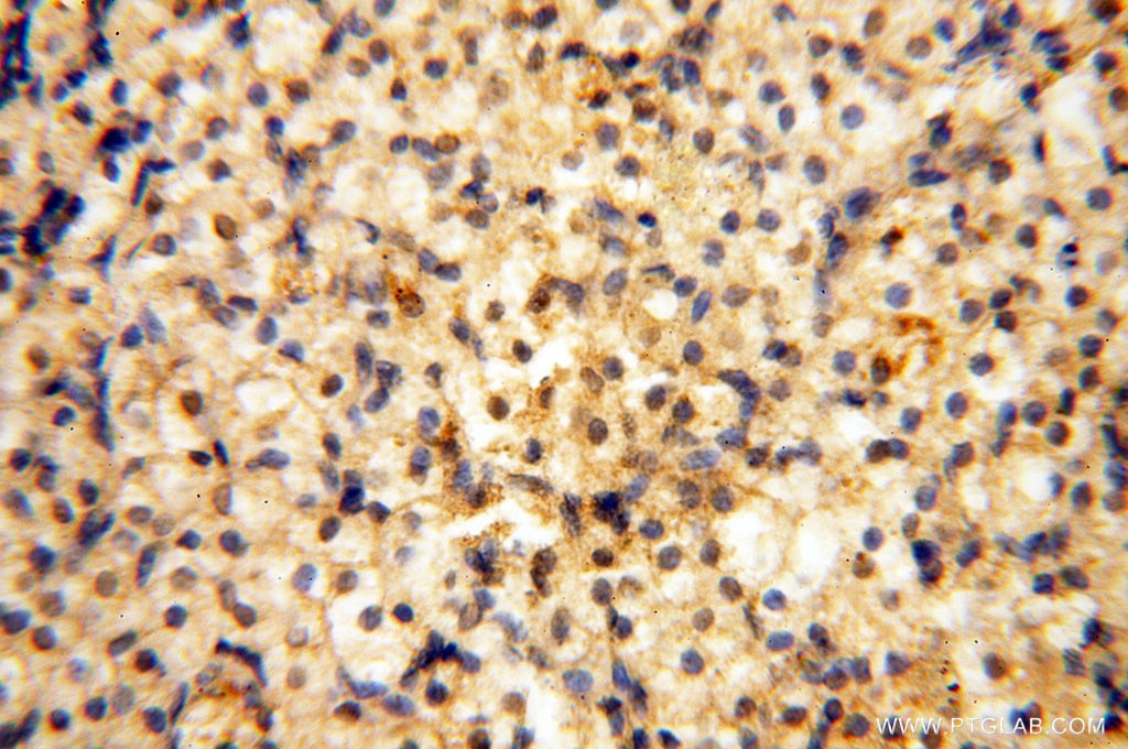 Immunohistochemistry (IHC) staining of human ovary tissue using HRASLS5 Polyclonal antibody (17581-1-AP)