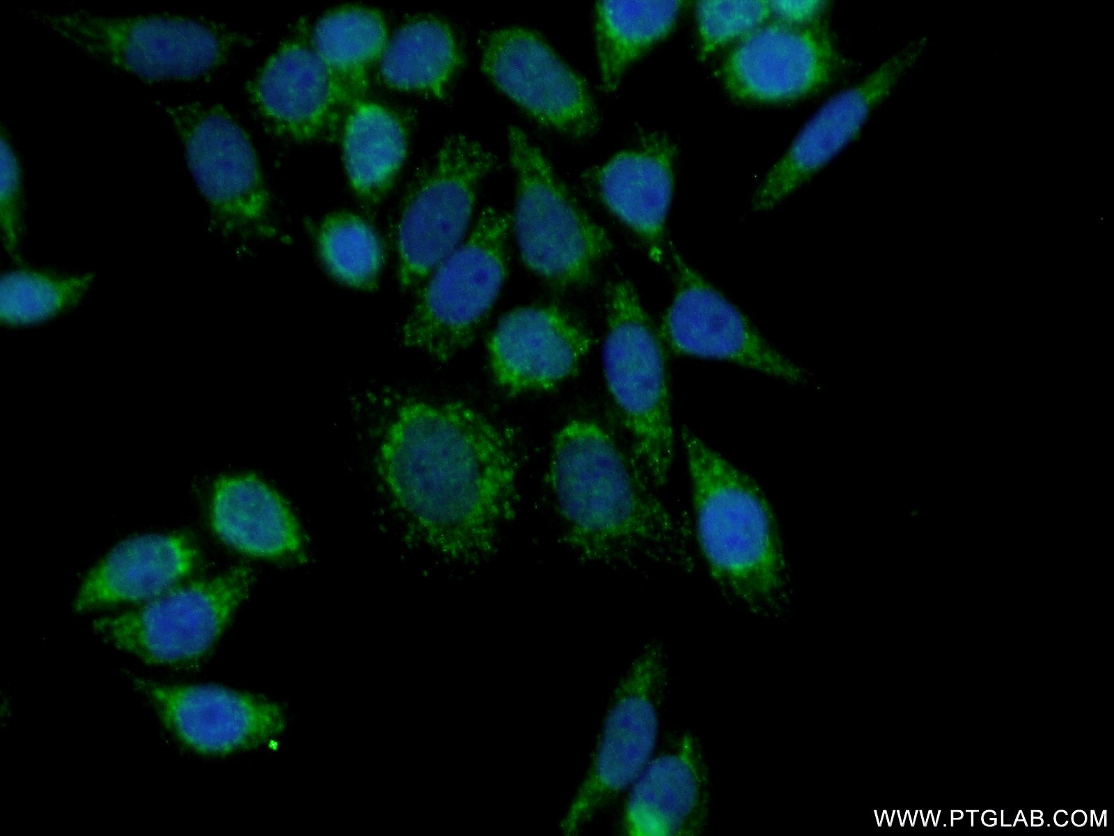 Immunofluorescence (IF) / fluorescent staining of HeLa cells using HRC Polyclonal antibody (18142-1-AP)