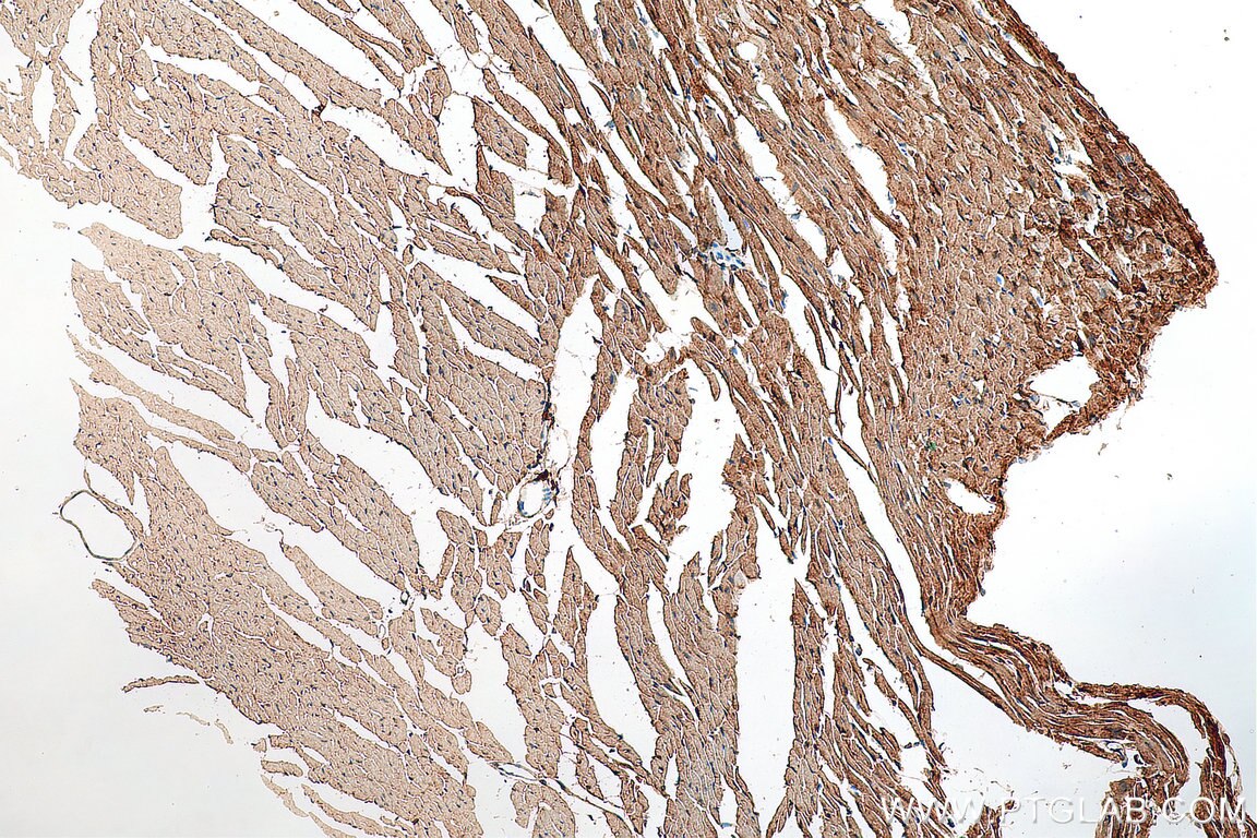 Immunohistochemistry (IHC) staining of mouse heart tissue using HRC Polyclonal antibody (18142-1-AP)