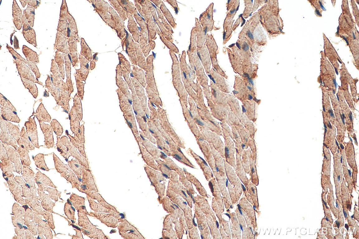 Immunohistochemistry (IHC) staining of mouse heart tissue using HRC Polyclonal antibody (18142-1-AP)