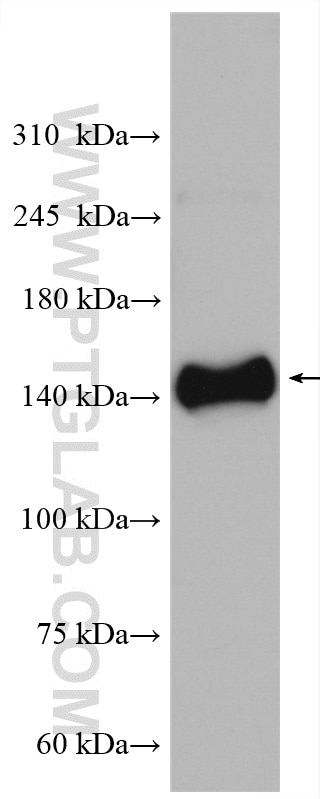 Western Blot (WB) analysis of mouse heart tissue using HRC Polyclonal antibody (18142-1-AP)