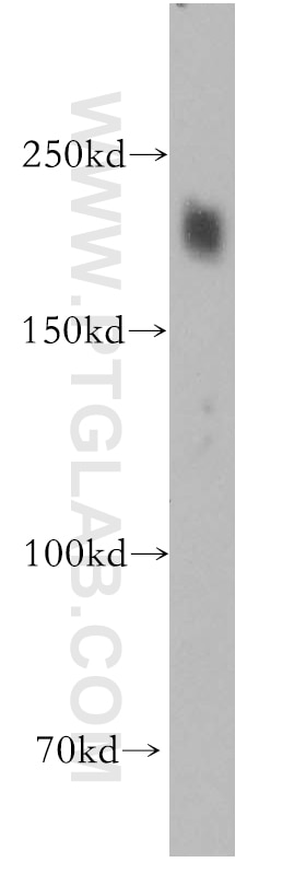 Western Blot (WB) analysis of mouse skeletal muscle tissue using HRC Polyclonal antibody (18142-1-AP)
