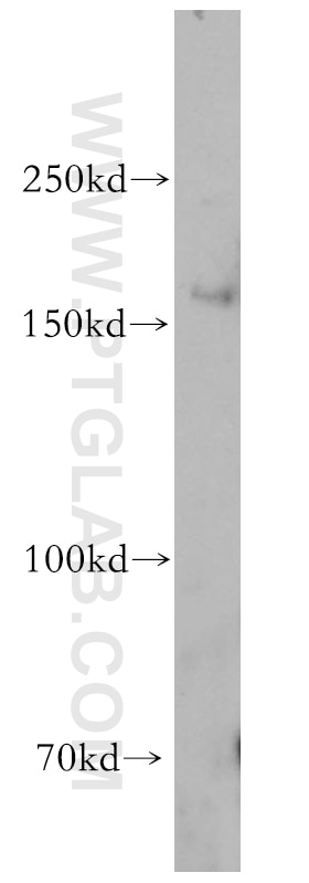 Western Blot (WB) analysis of HeLa cells using HRC Polyclonal antibody (18142-1-AP)