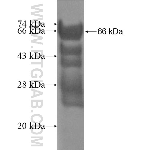 HRC fusion protein Ag12794 SDS-PAGE