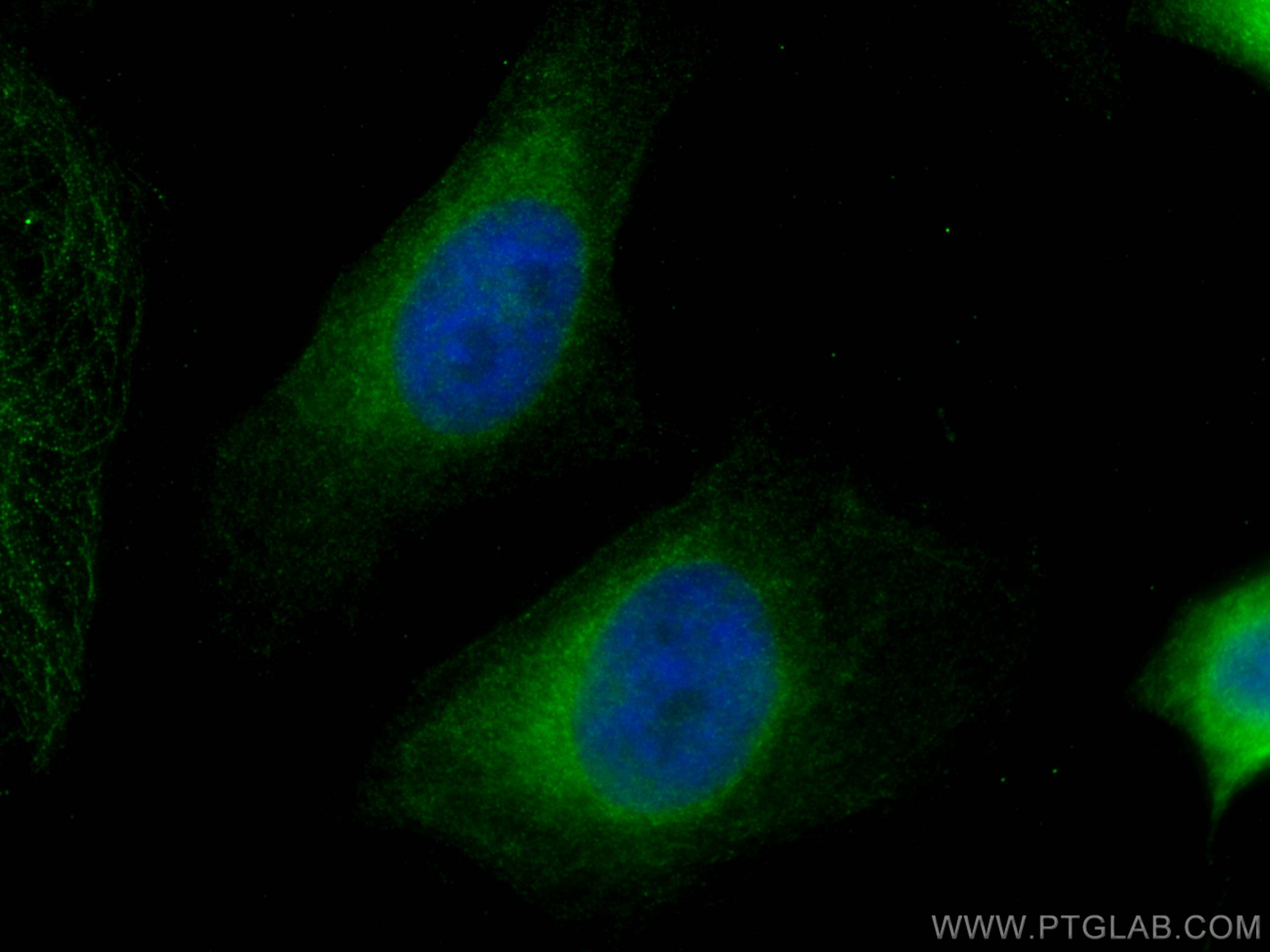 Immunofluorescence (IF) / fluorescent staining of HeLa cells using HRD1/SYVN1 Monoclonal antibody (67488-1-Ig)