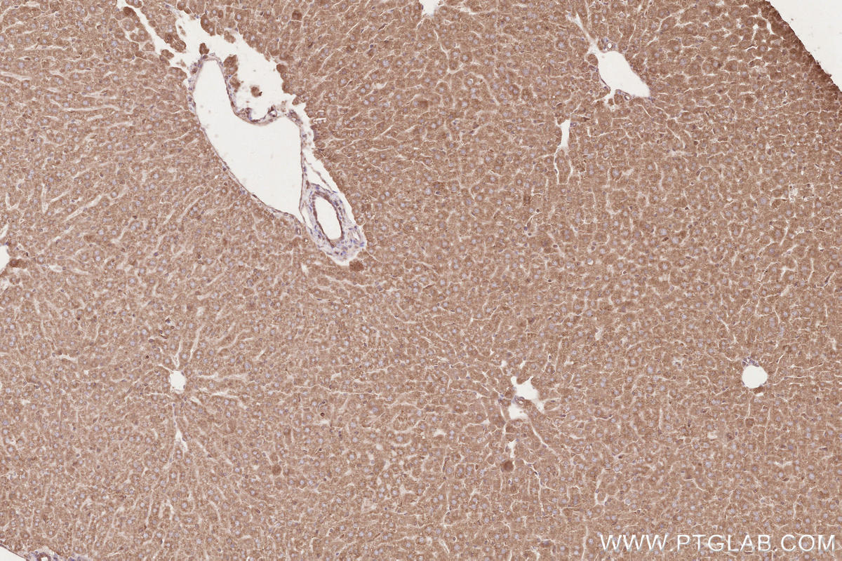 IHC staining of mouse liver using 67488-1-Ig Immunohistochemistry (IHC) staining of mouse liver tissue using HRD1/SYVN1 Monoclonal antibody (67488-1-Ig)