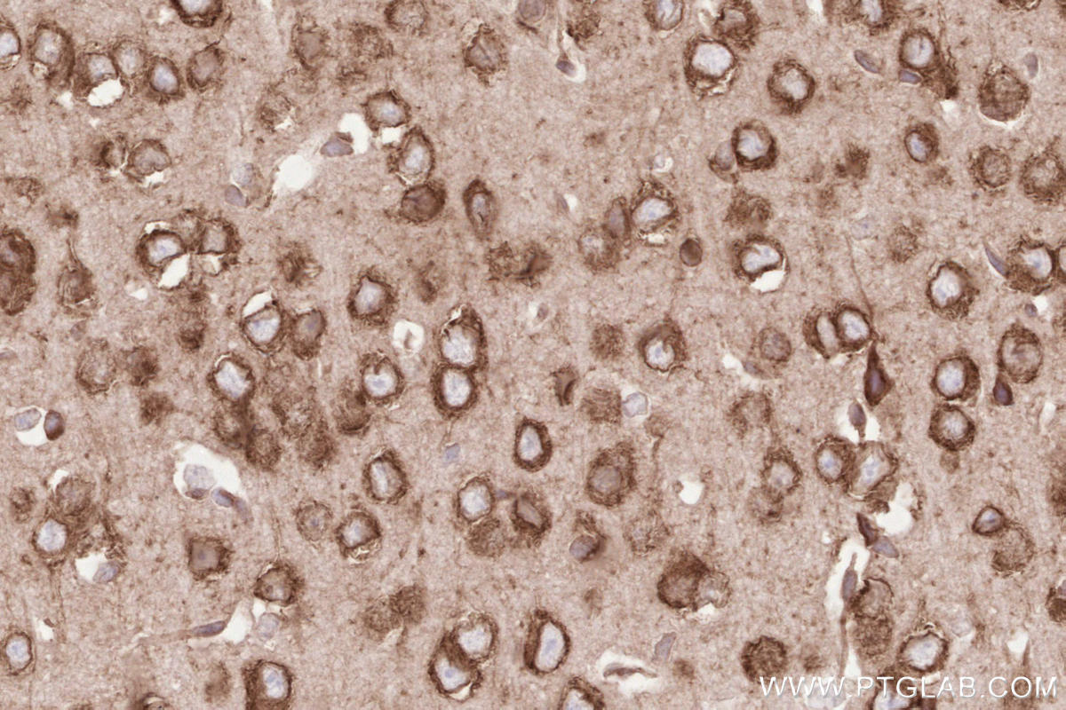 IHC staining of mouse brain using 67488-1-Ig Immunohistochemistry (IHC) staining of mouse brain tissue using HRD1/SYVN1 Monoclonal antibody (67488-1-Ig)