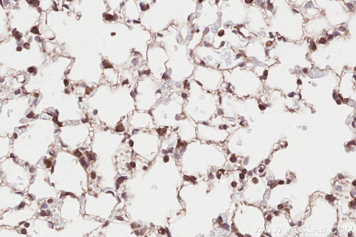 IHC staining of mouse lung using 67488-1-Ig Immunohistochemistry (IHC) staining of mouse lung tissue using HRD1/SYVN1 Monoclonal antibody (67488-1-Ig)