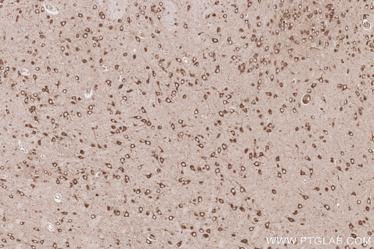 IHC staining of rat brain using 67488-1-Ig Immunohistochemistry (IHC) staining of rat brain tissue using HRD1/SYVN1 Monoclonal antibody (67488-1-Ig)
