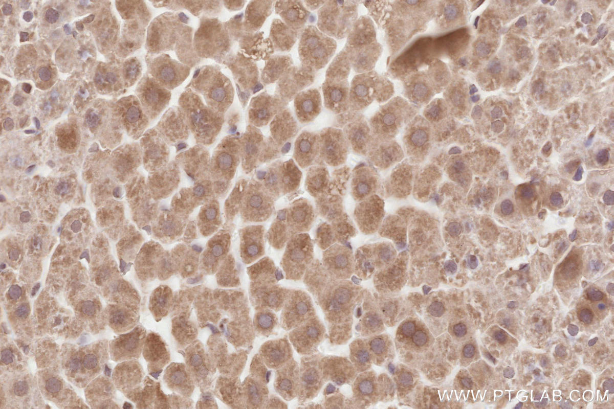 IHC staining of rat liver using 67488-1-Ig Immunohistochemistry (IHC) staining of rat liver tissue using HRD1/SYVN1 Monoclonal antibody (67488-1-Ig)