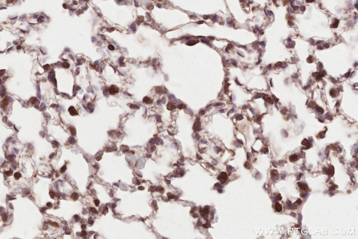 IHC staining of rat lung using 67488-1-Ig Immunohistochemistry (IHC) staining of rat lung tissue using HRD1/SYVN1 Monoclonal antibody (67488-1-Ig)