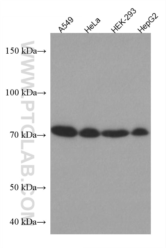 Western Blot (WB) analysis of various lysates using HRD1/SYVN1 Monoclonal antibody (67488-1-Ig)