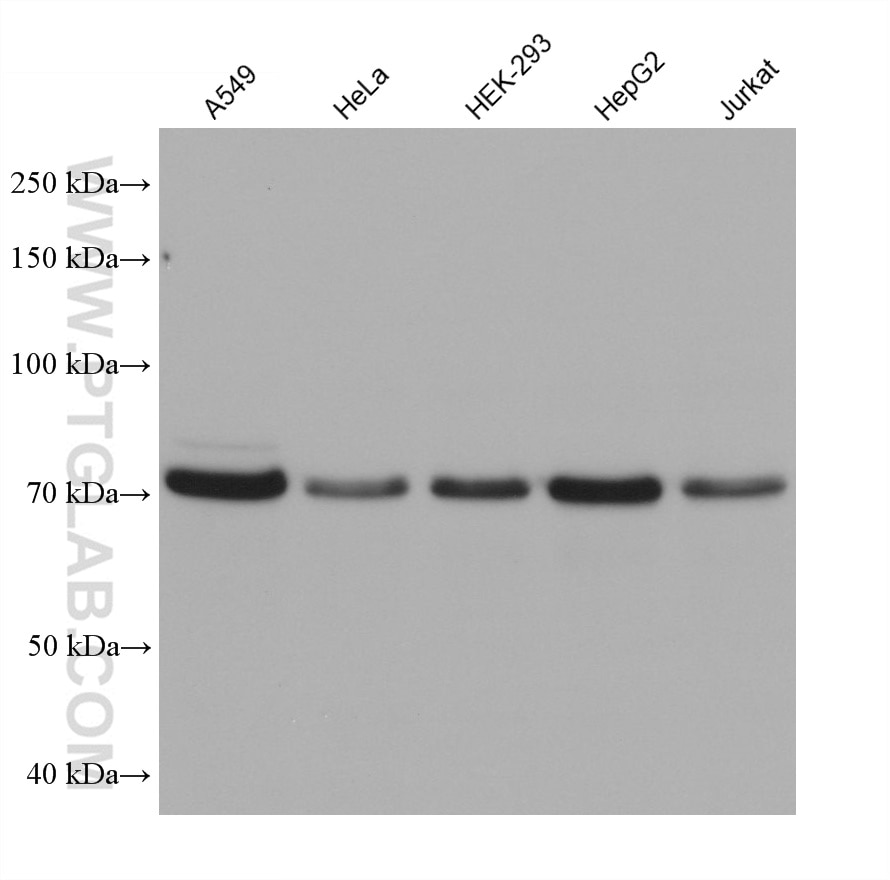 Western Blot (WB) analysis of various lysates using HRD1/SYVN1 Monoclonal antibody (67488-1-Ig)