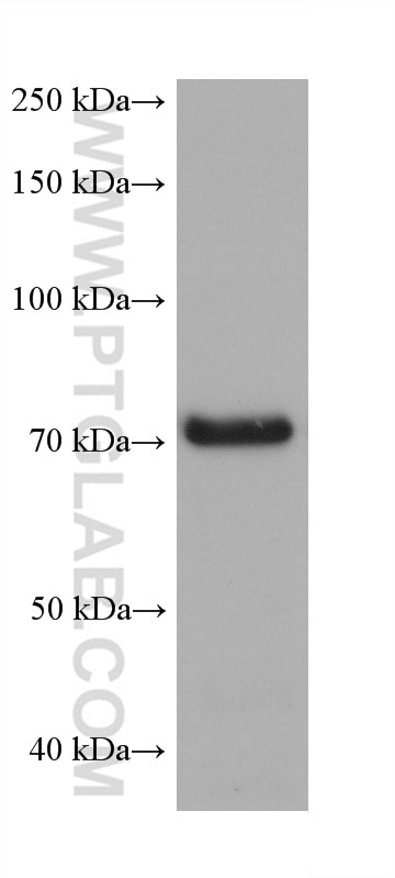 Western Blot (WB) analysis of 4T1 cells using HRD1/SYVN1 Monoclonal antibody (67488-1-Ig)
