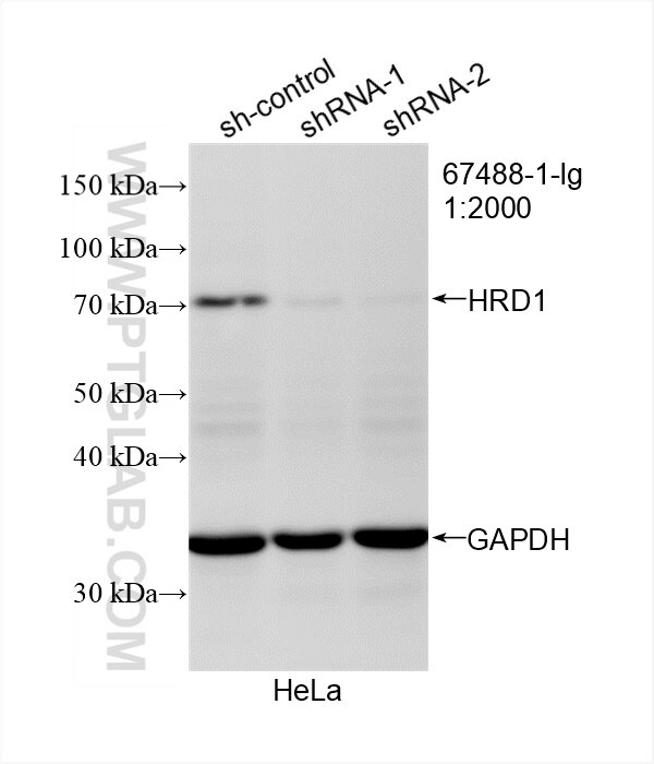 Western Blot (WB) analysis of HeLa cells using HRD1/SYVN1 Monoclonal antibody (67488-1-Ig)