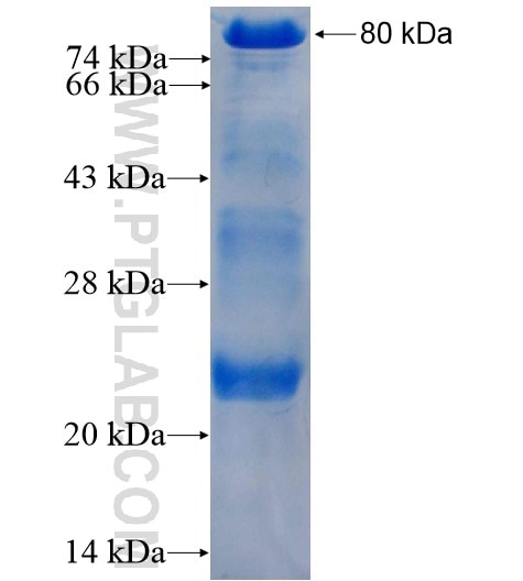 HRD1 fusion protein Ag4267 SDS-PAGE