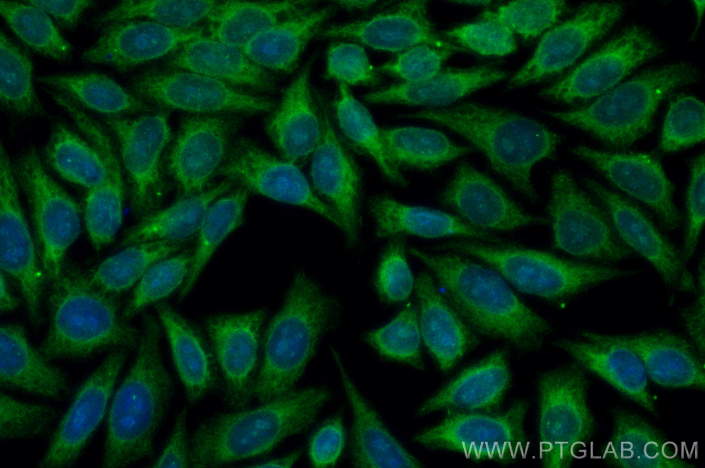 Immunofluorescence (IF) / fluorescent staining of HepG2 cells using CoraLite® Plus 488-conjugated HRD1/SYVN1 Polyclona (CL488-13473)