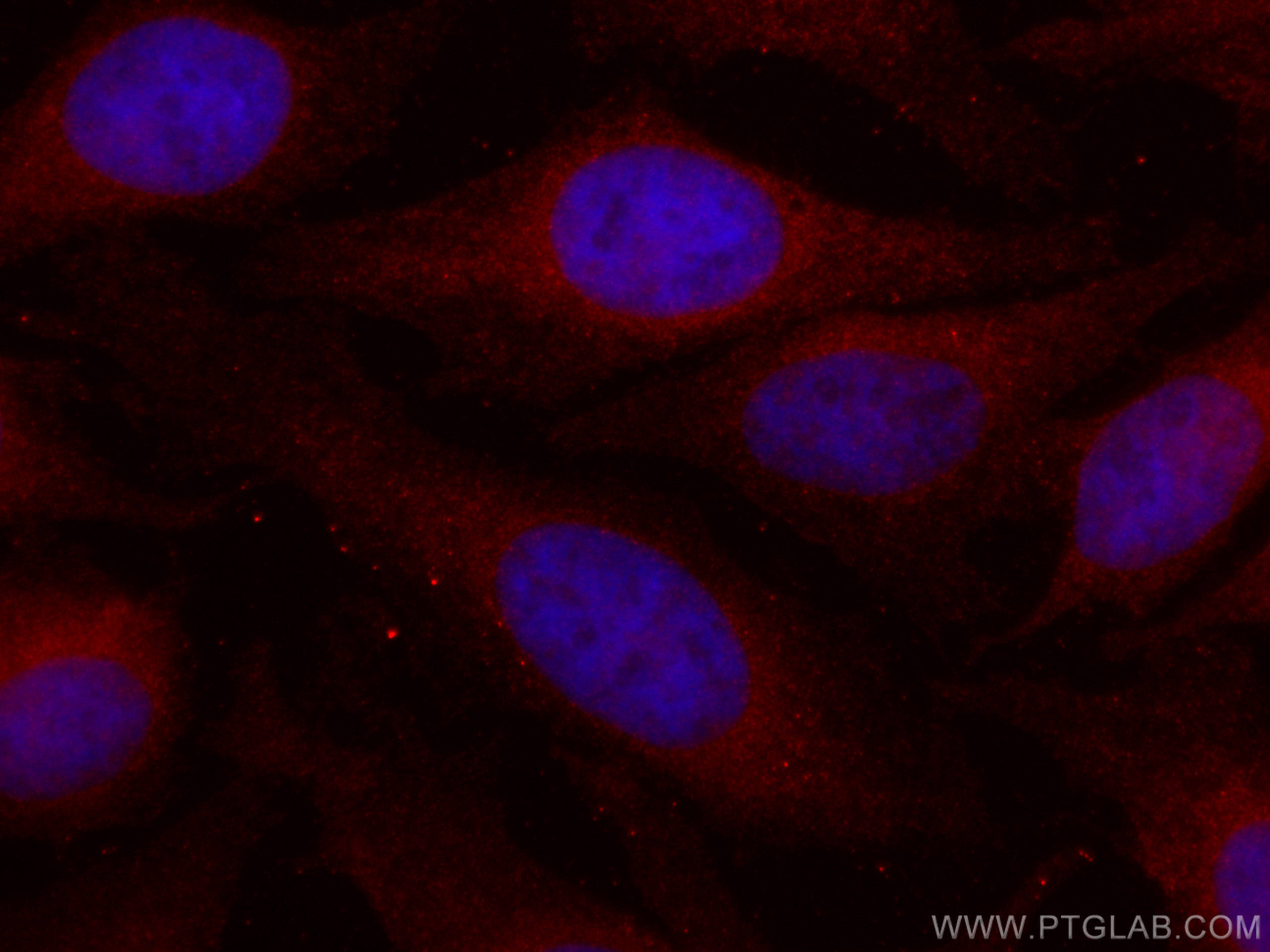 Immunofluorescence (IF) / fluorescent staining of HeLa cells using CoraLite®594-conjugated HRD1/SYVN1 Monoclonal anti (CL594-67488)