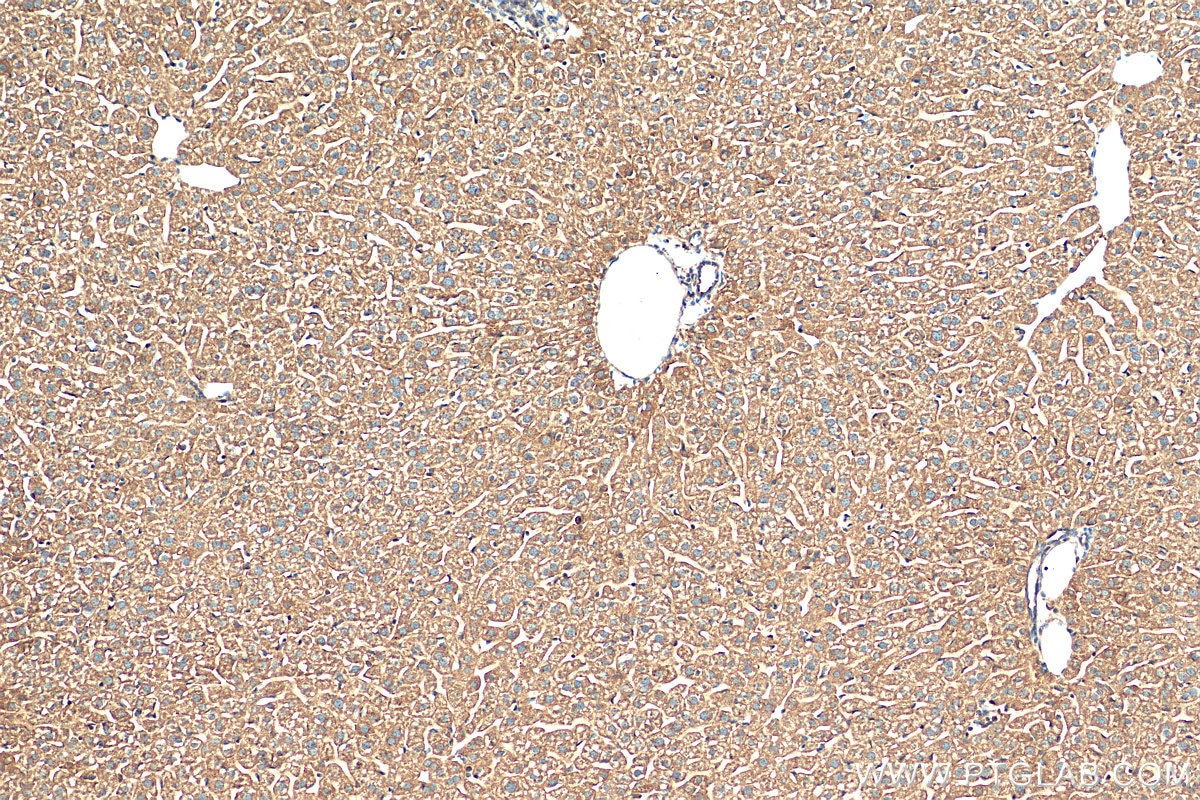 IHC staining of mouse liver using 26252-1-AP