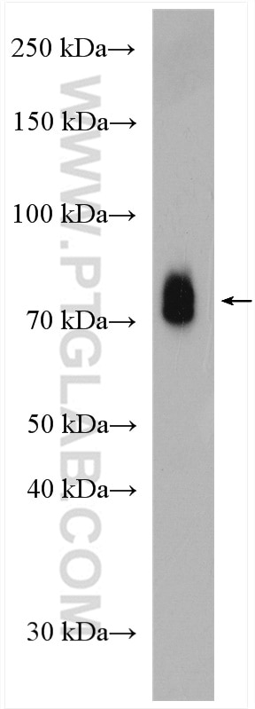 Western Blot (WB) analysis of human plasma using HRG Polyclonal antibody (26252-1-AP)