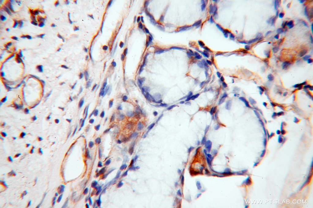 Immunohistochemistry (IHC) staining of human trachea tissue using HRH1 Polyclonal antibody (13413-1-AP)