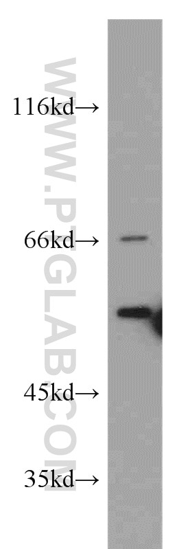 Western Blot (WB) analysis of Jurkat cells using HRH1 Polyclonal antibody (13413-1-AP)