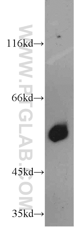 Western Blot (WB) analysis of human colon tissue using HRH1 Polyclonal antibody (13413-1-AP)