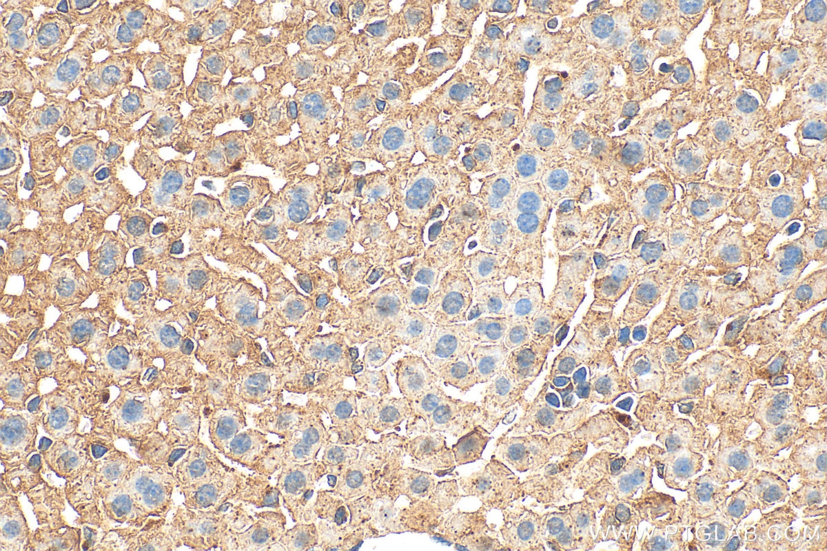 Immunohistochemistry (IHC) staining of mouse liver tissue using HRH1 Polyclonal antibody (28763-1-AP)