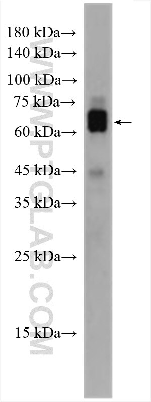 Western Blot (WB) analysis of rat brain tissue using HRH1 Polyclonal antibody (28763-1-AP)