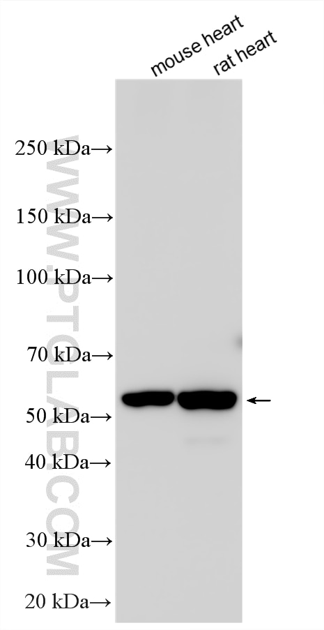 Western Blot (WB) analysis of various lysates using HRH1 Polyclonal antibody (28763-1-AP)
