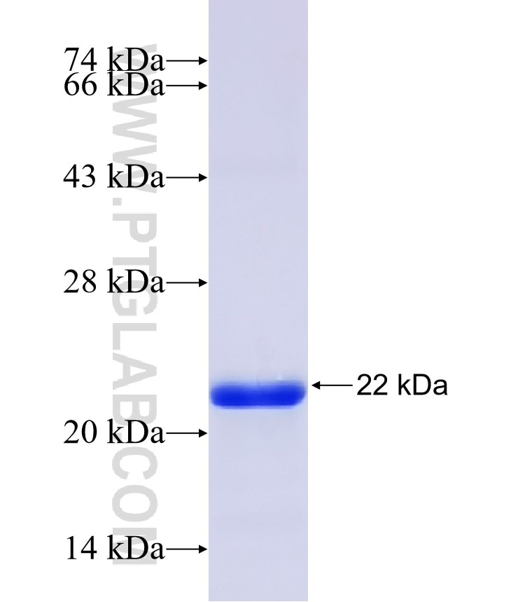 HRH1 fusion protein Ag30481 SDS-PAGE HRH1 fusion protein Ag30481 SDS-PAGE