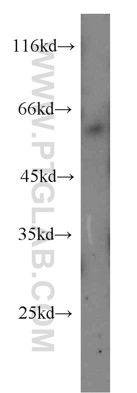 Western Blot (WB) analysis of human skeletal muscle tissue using HRH2 Polyclonal antibody (13414-1-AP)