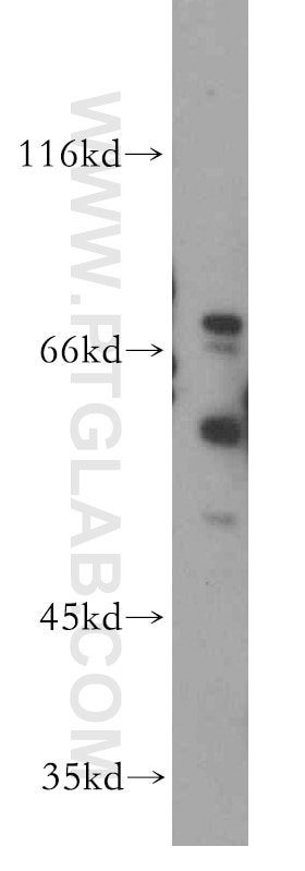 Western Blot (WB) analysis of SH-SY5Y cells using HRH2 Polyclonal antibody (13414-1-AP)