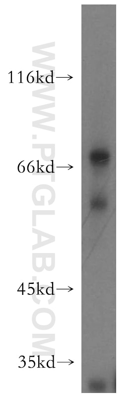 Western Blot (WB) analysis of mouse stomach tissue using HRH2 Polyclonal antibody (13414-1-AP)