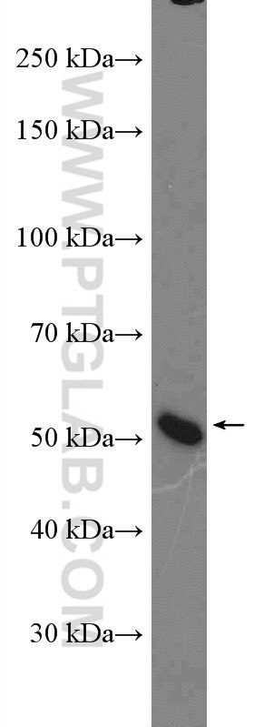 Western Blot (WB) analysis of mouse liver tissue using HRH4-Specific Polyclonal antibody (20362-1-AP)