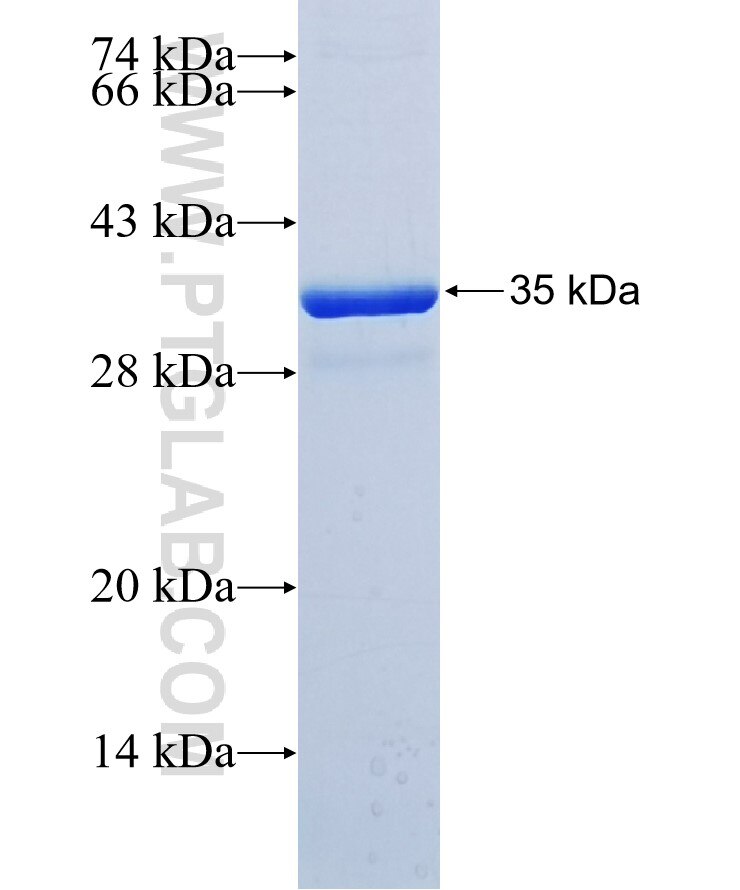 HRNR fusion protein Ag37573 SDS-PAGE