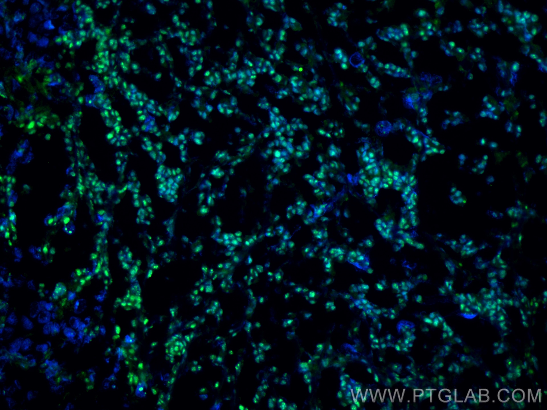 Immunofluorescence (IF) / fluorescent staining of mouse breast cancer using HRPT2, CDC73 Monoclonal antibody (66490-1-Ig)